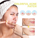 OUHOE Yellow Patch Mild Ingredients Moisturize  Cleanse And Care For Facial Acne Patches