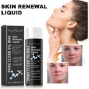 West Month Skin Renewal Liquid  Reduce Acne Print Repair Acne Muscle Mild Clear Acne Hydrating Essence