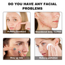 OUHOE Yellow Patch Mild Ingredients Moisturize  Cleanse And Care For Facial Acne Patches