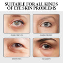 Hoygi Anti Wrinkle Whitening Cream   Black Rim Of Eye Pouch Firming Moisture To Brighten The