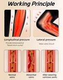 Meia-calça de compressão médica 34-46mmhg mulheres coxas dedo do pé aberto classe 3 suporte de pressão meia de veias varicosas plus size