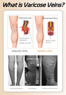 Meia-calça de compressão médica 34-46mmhg mulheres coxas dedo do pé aberto classe 3 suporte de pressão meia de veias varicosas plus size
